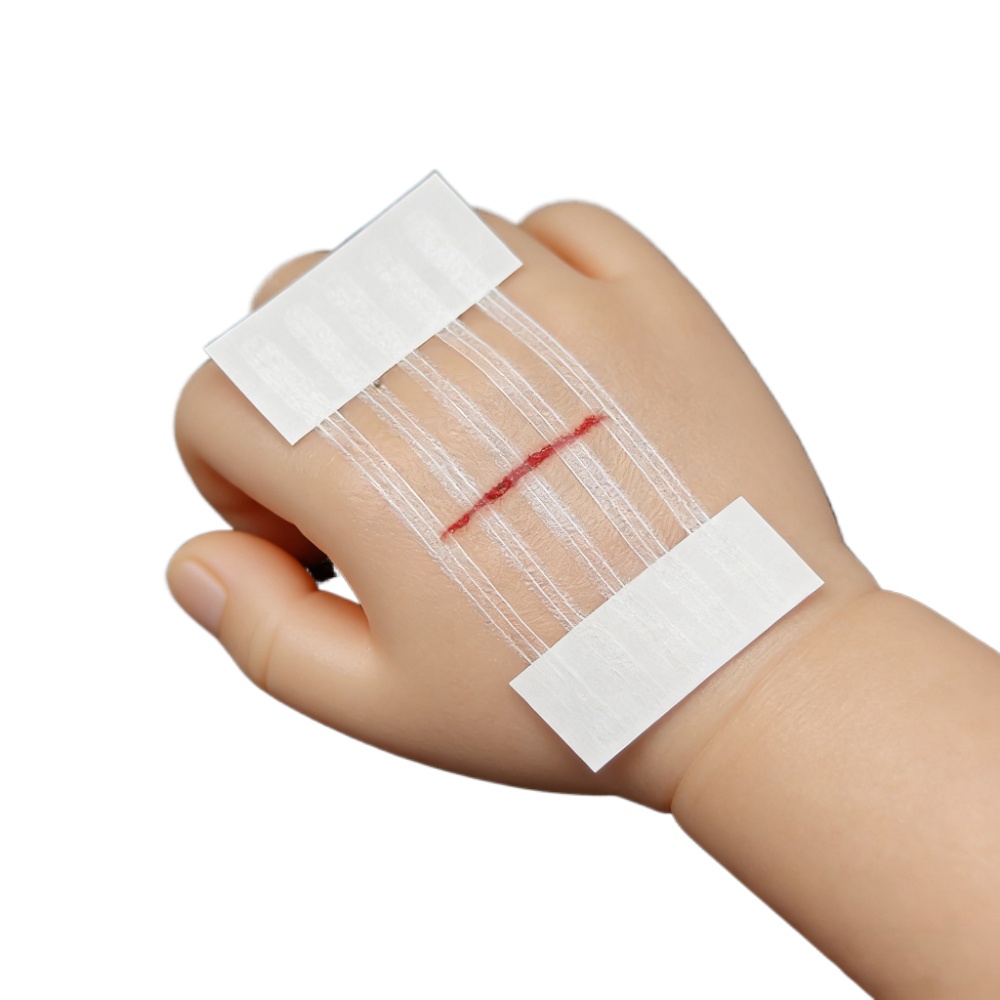 5 Strisce Adesive per Chiusura - Medical Label recensione e prezzo